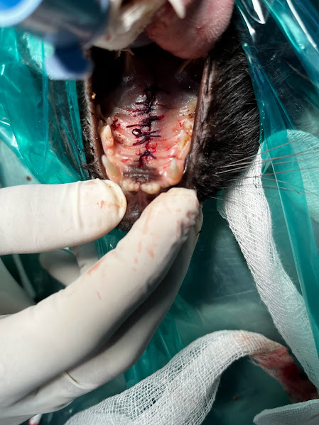 Cleft palate Surgery